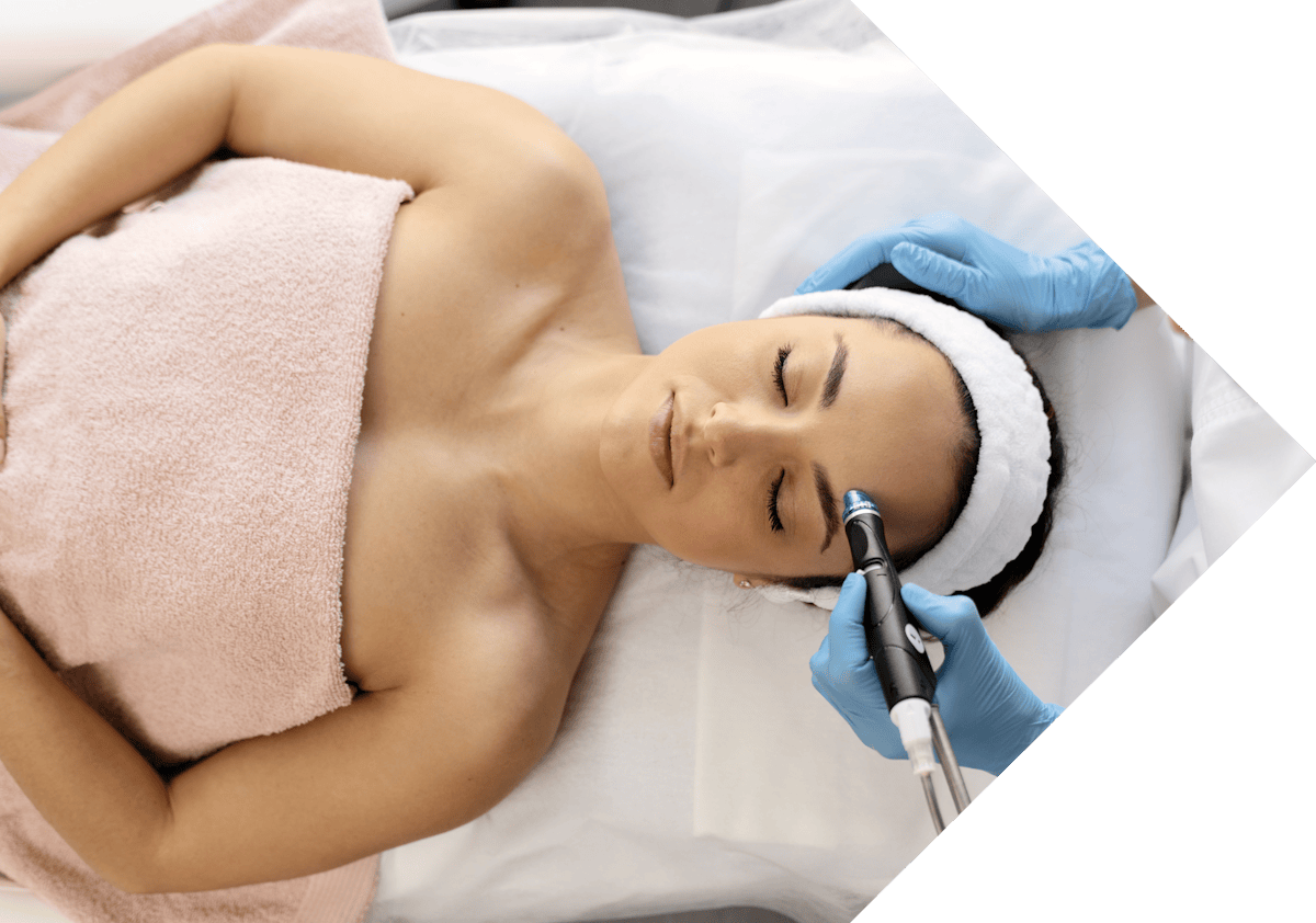 cryopen skin tag removal being performed