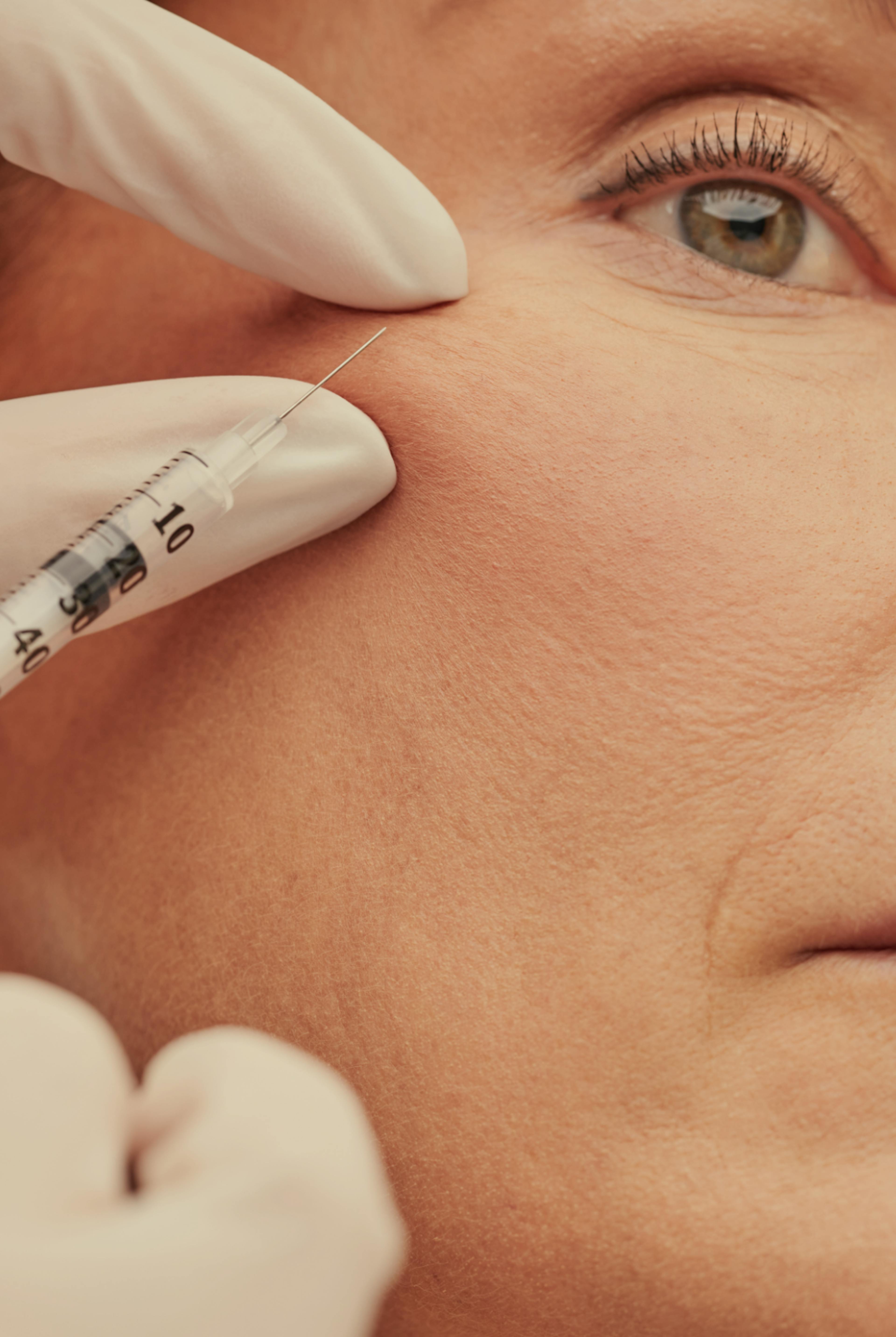 anti wrinkle injection being performed