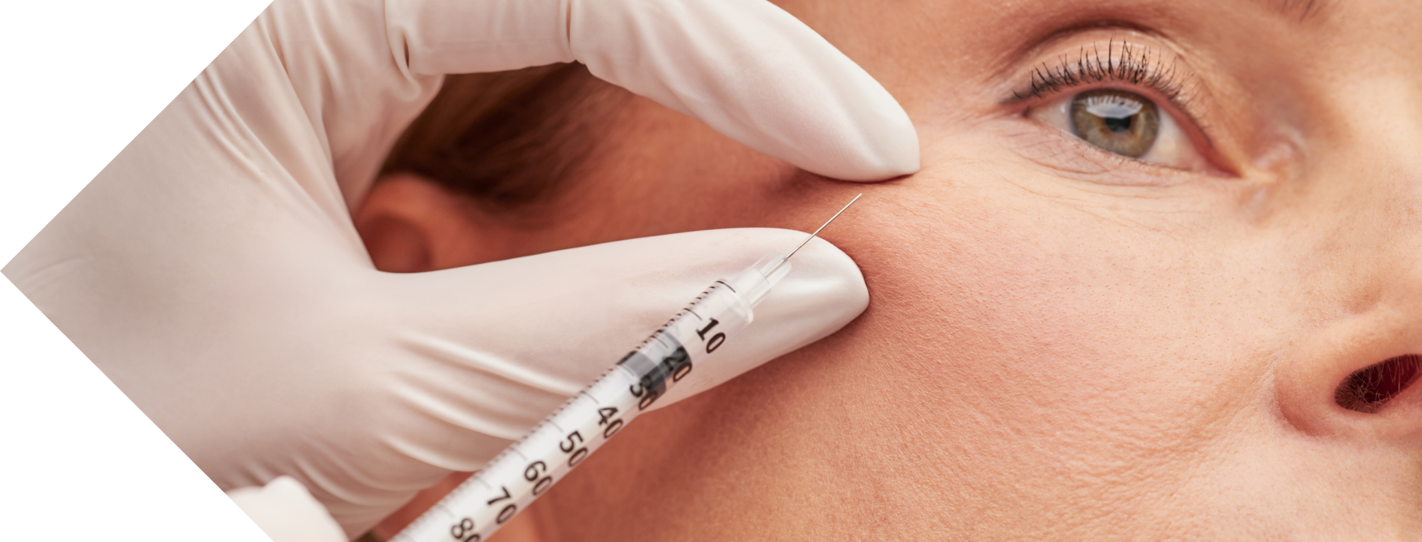 anti wrinkle injection being performed