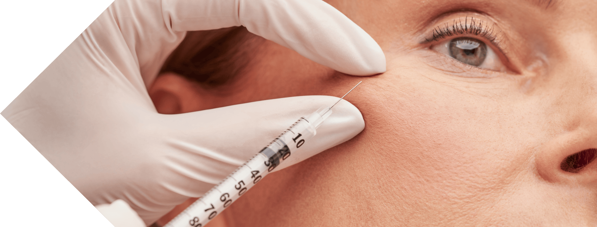 anti wrinkle injection being performed