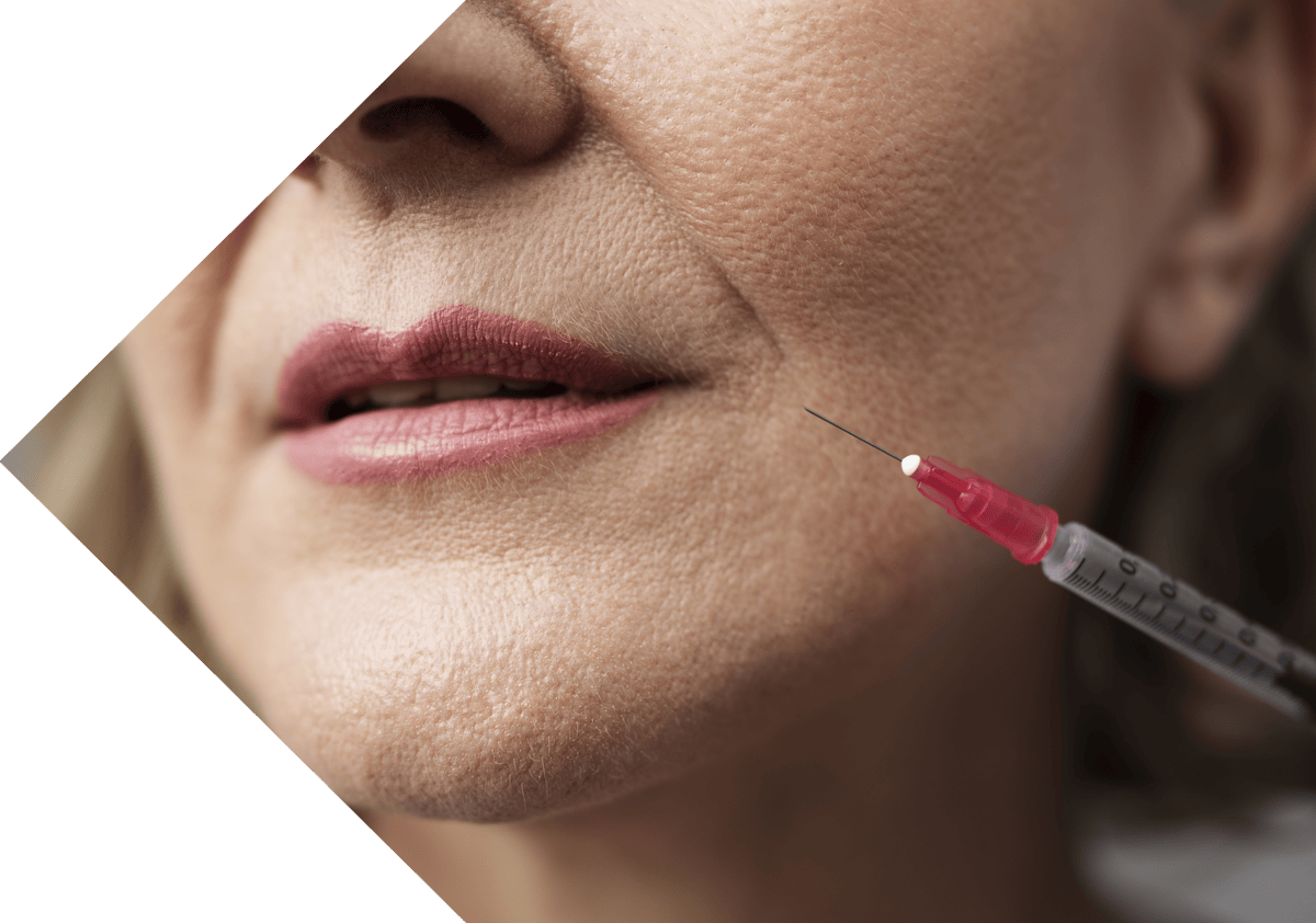 woman having an anti wrinkle injection