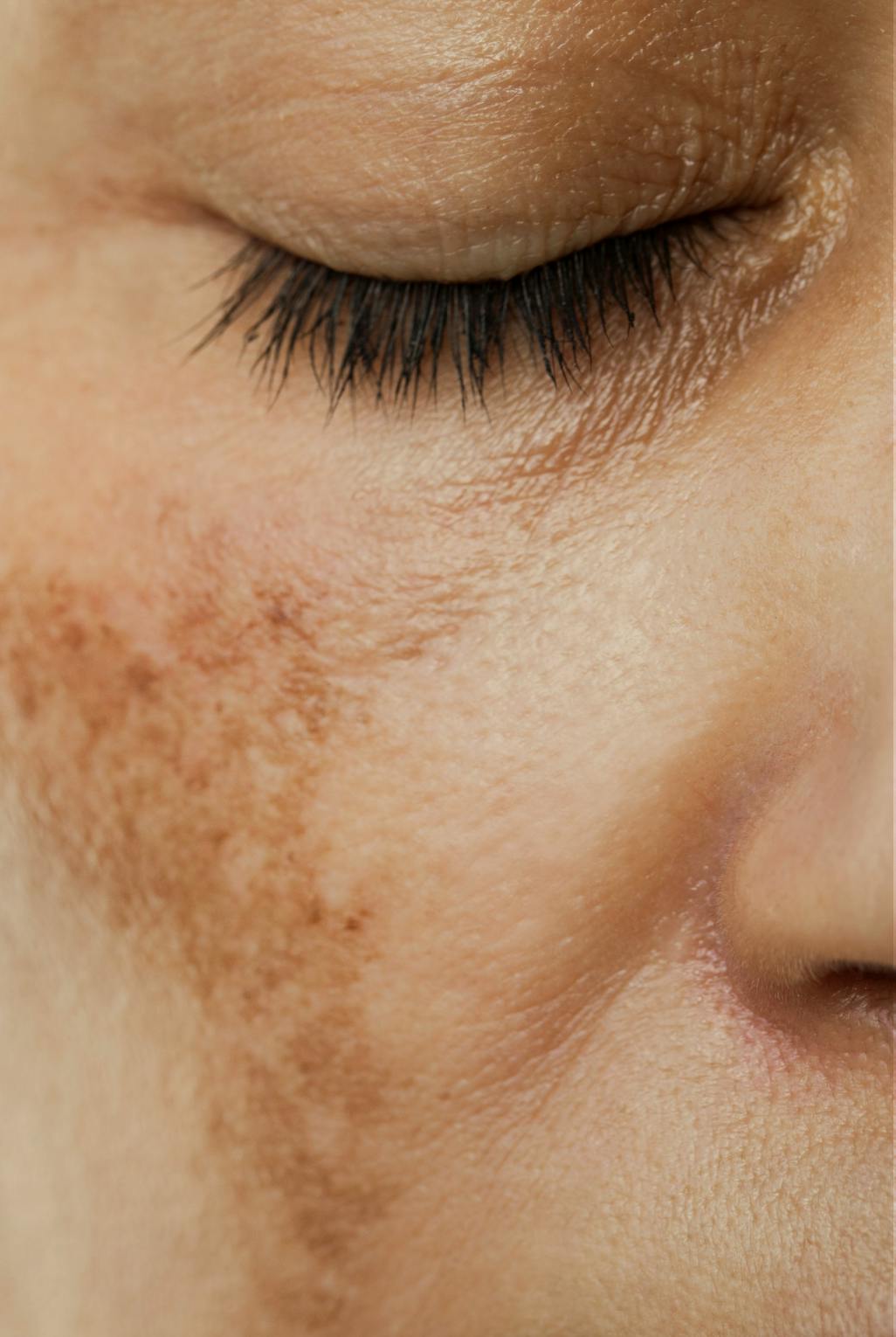 close up of a womans face with age spots