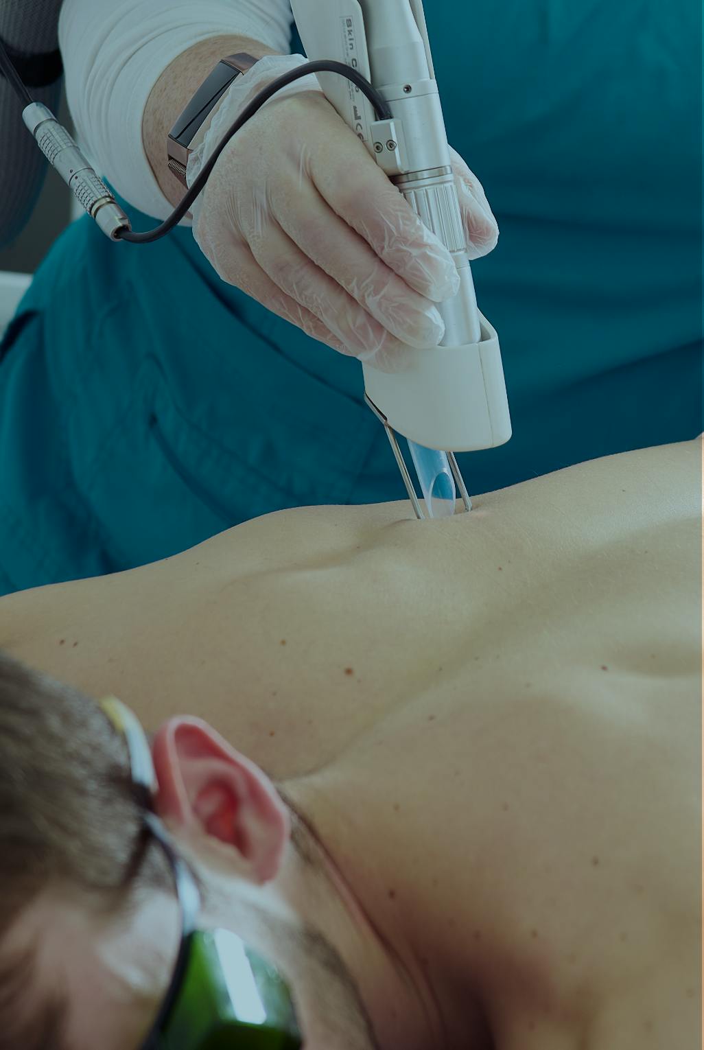 Man having laser hair removal on his back