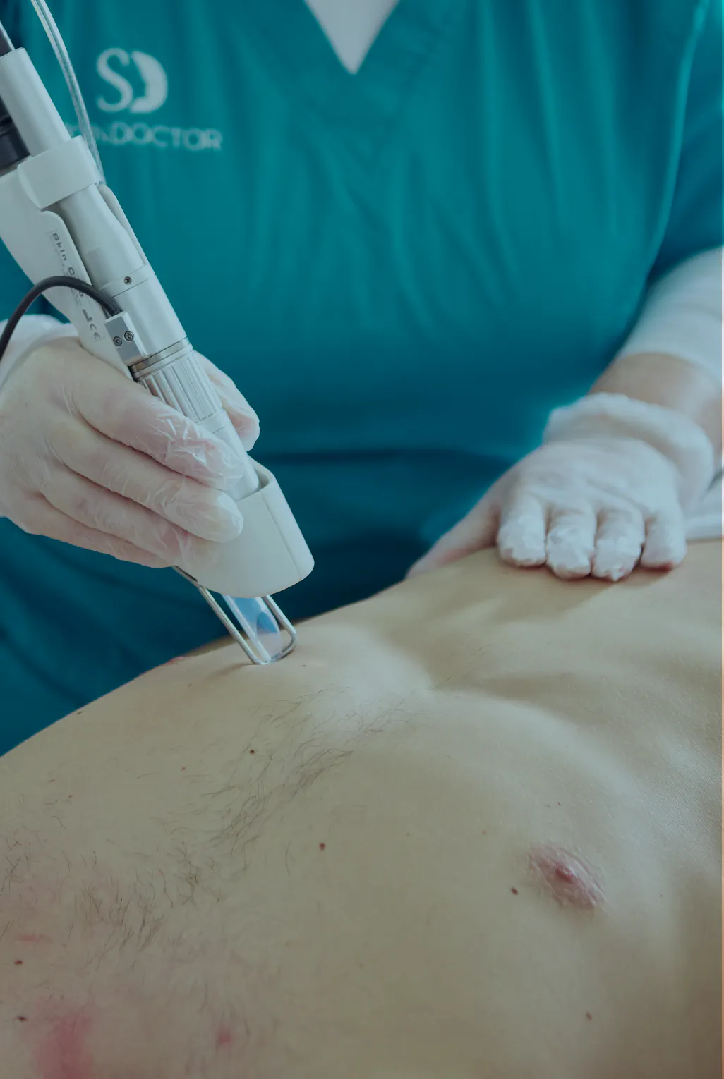 A male patient receiving laser hair removal on his body