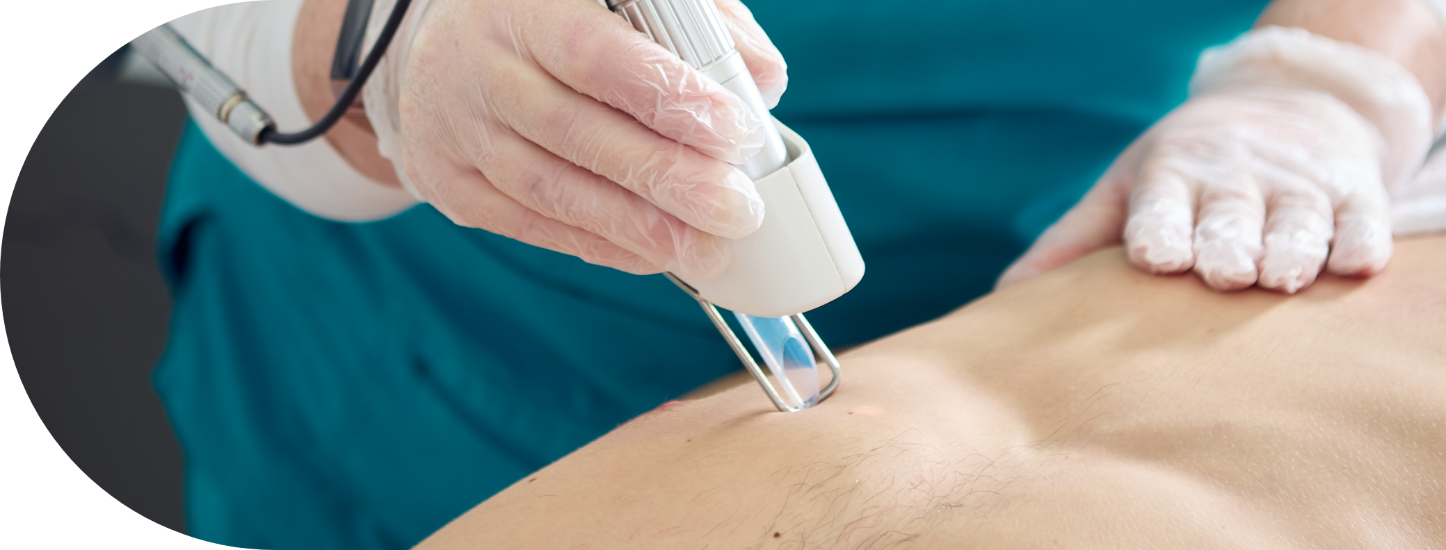 A male patient receiving laser hair removal on his body