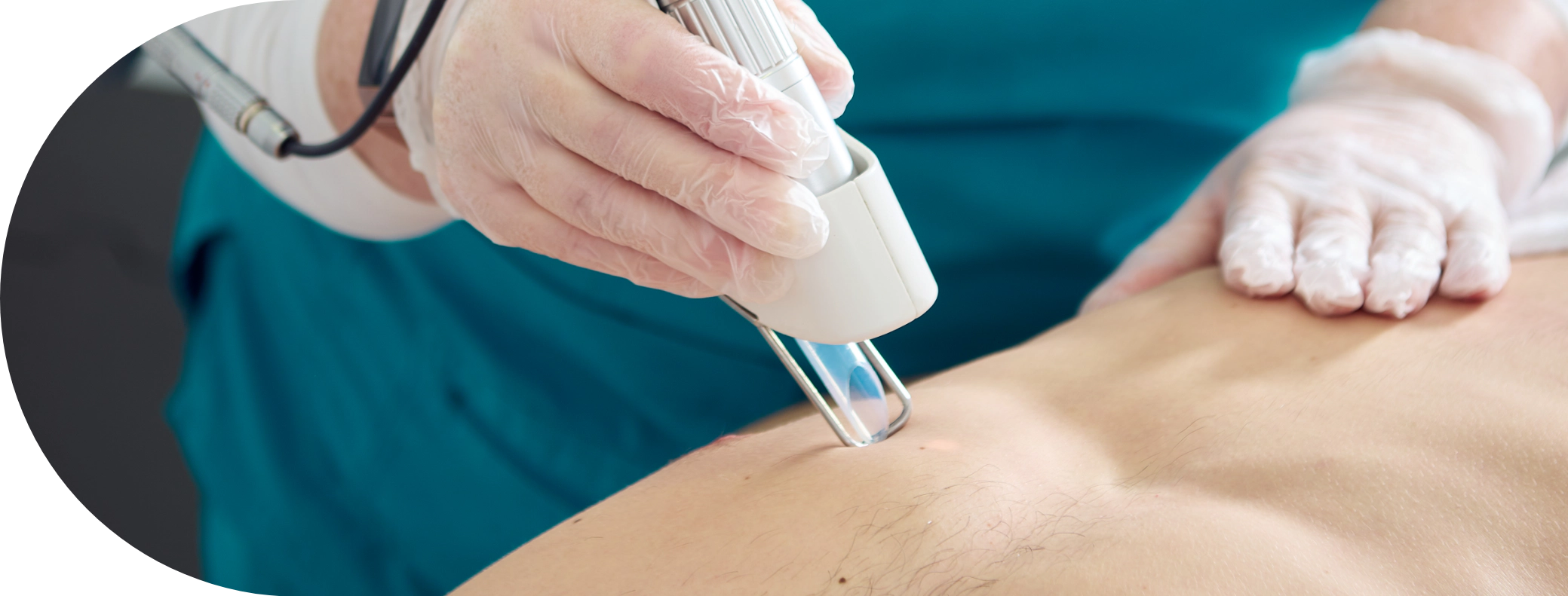 A male patient receiving laser hair removal on his body