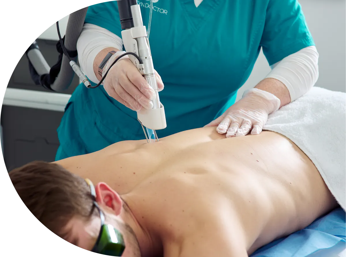 A male patient receiving laser hair removal on his back