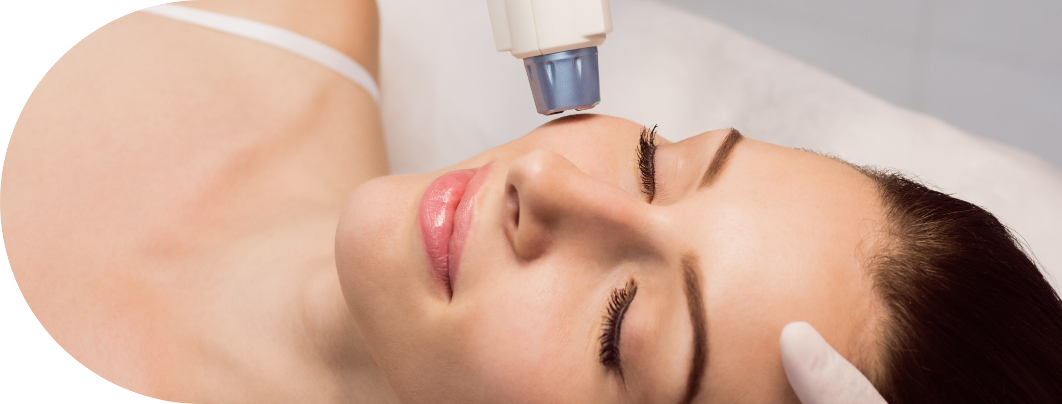 A female patient receiving laser hair removal on her face