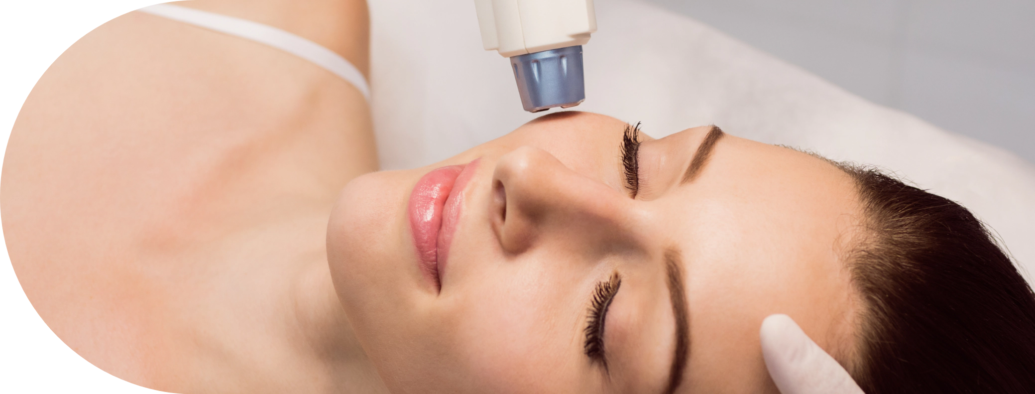 A female patient receiving laser hair removal on her face