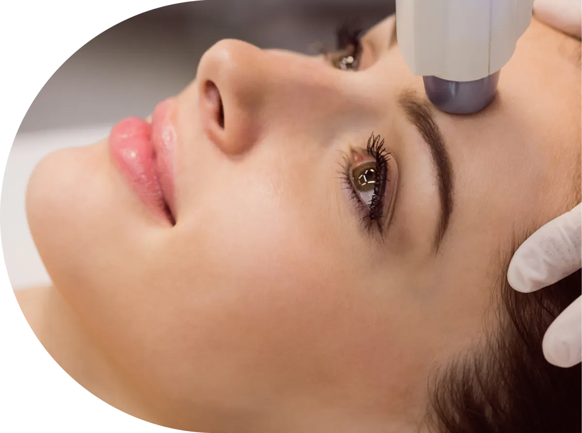 A female patient receiving laser hair removal on her face