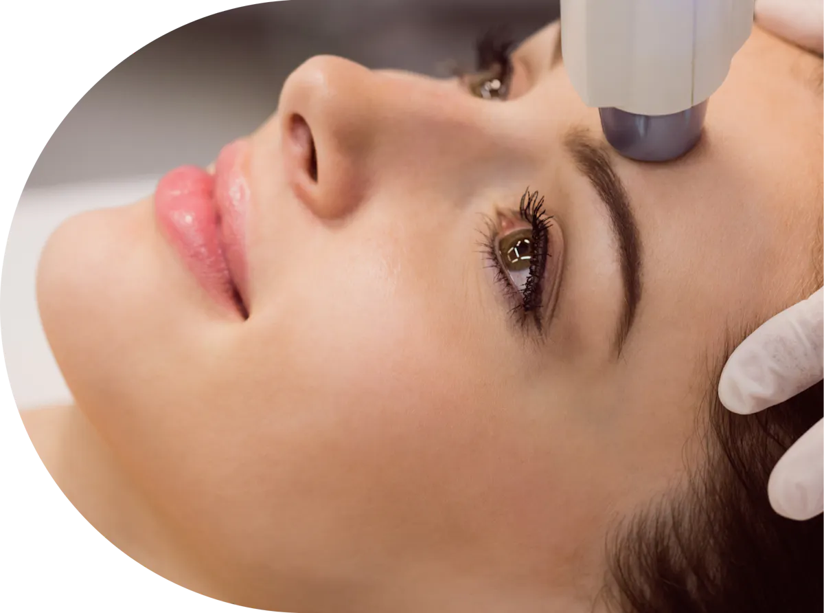 A female patient receiving laser hair removal on her face