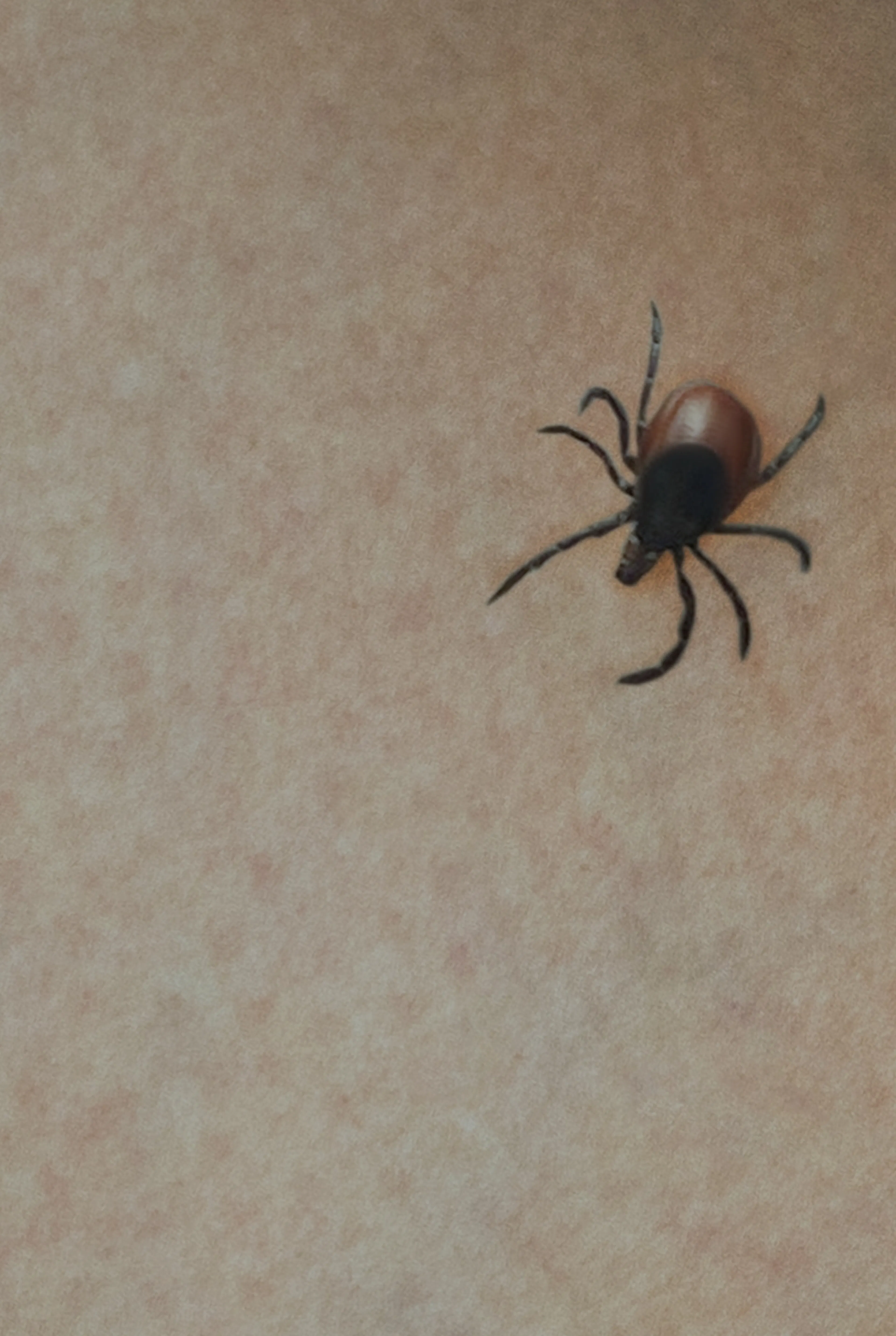 A tick on the arm of a human