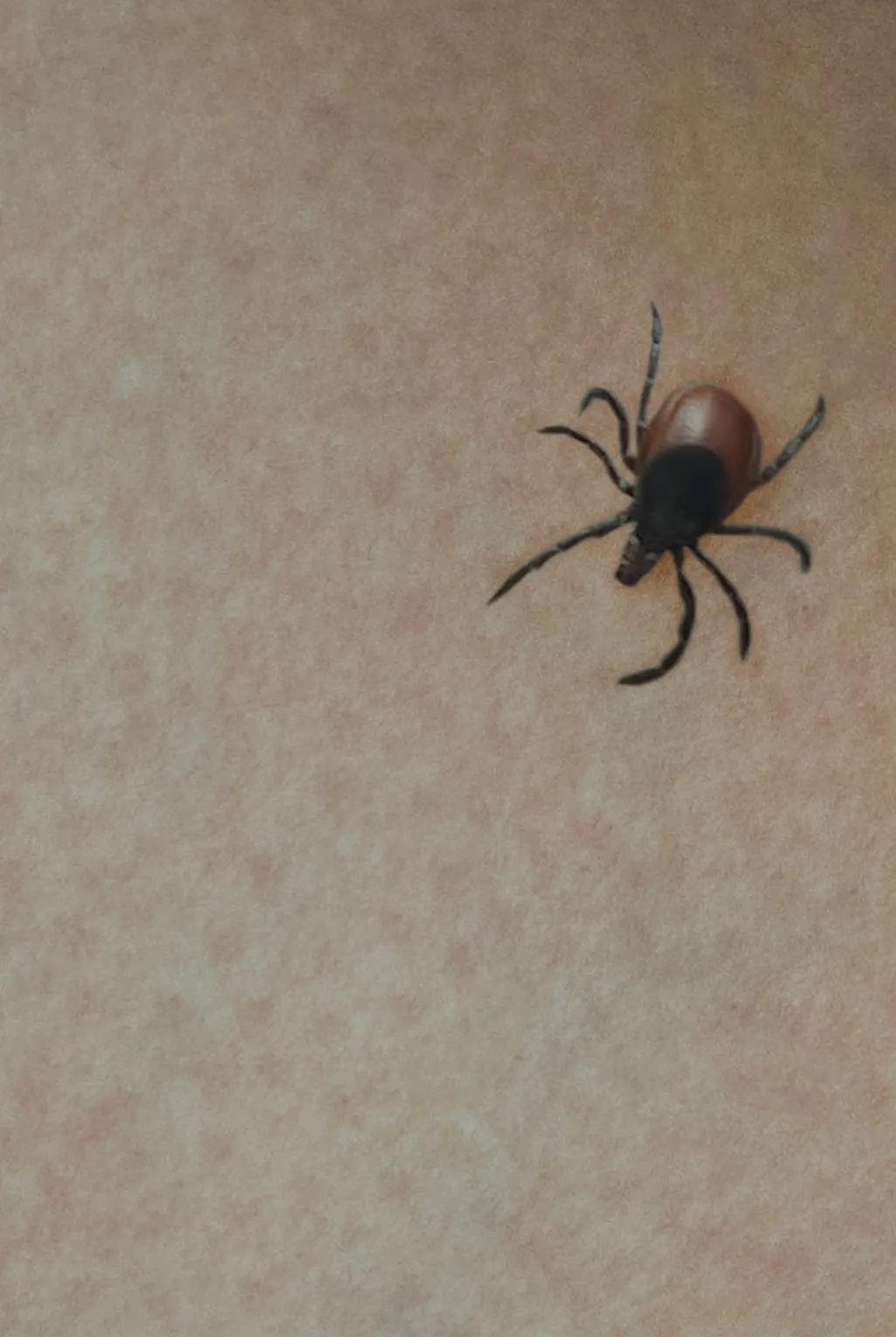 A tick on the arm of a human