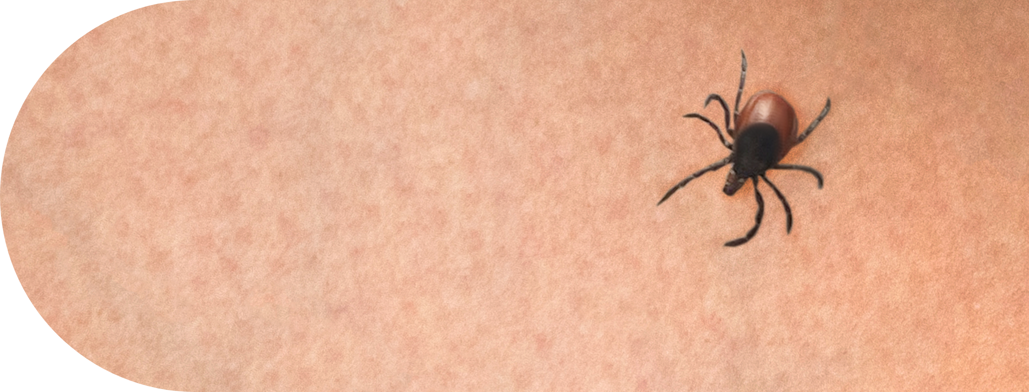 A tick on the arm of a human