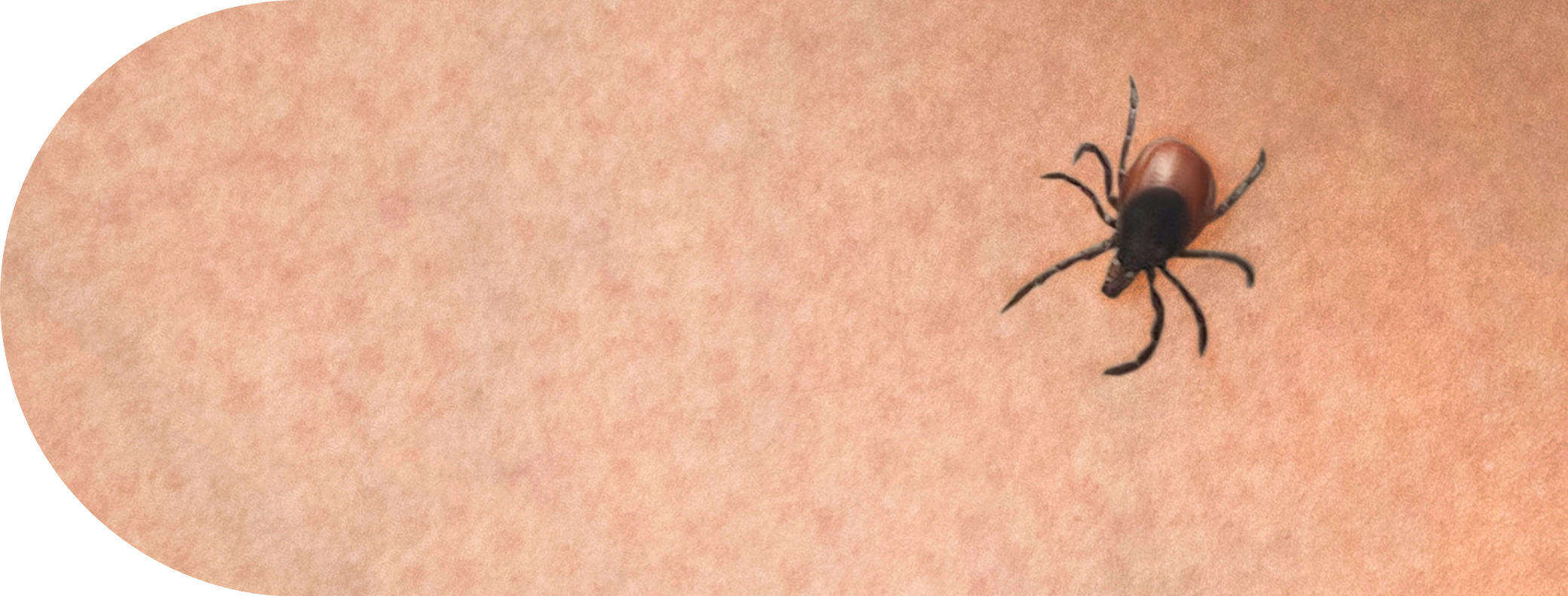 A tick on the arm of a human