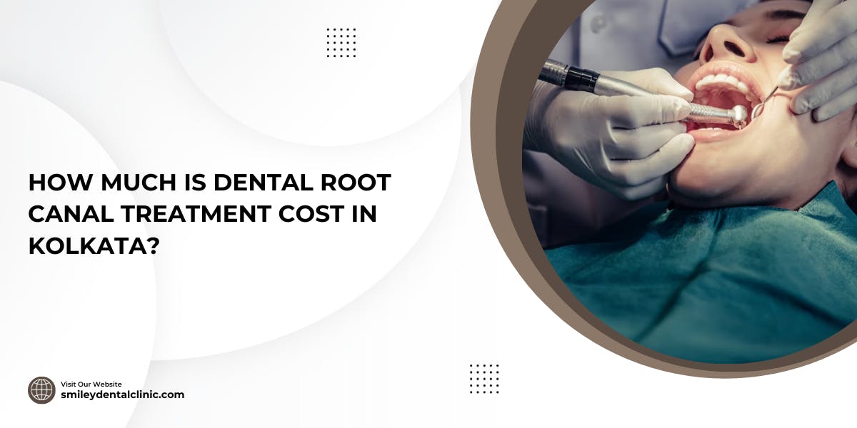How Much Is Dental Root Canal Treatment Cost In Kolkata - blog poster