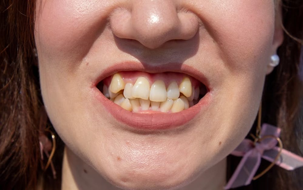 common dental problems