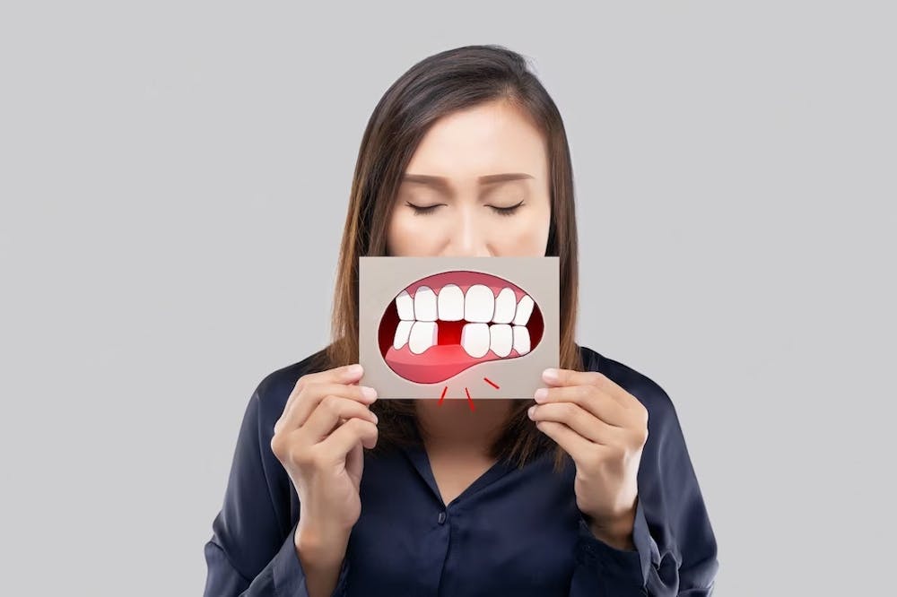 common dental problems