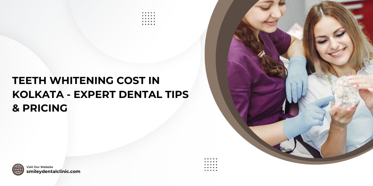 Teeth Whitening Cost in Kolkata - Expert Dental Tips & Pricing - blog poster