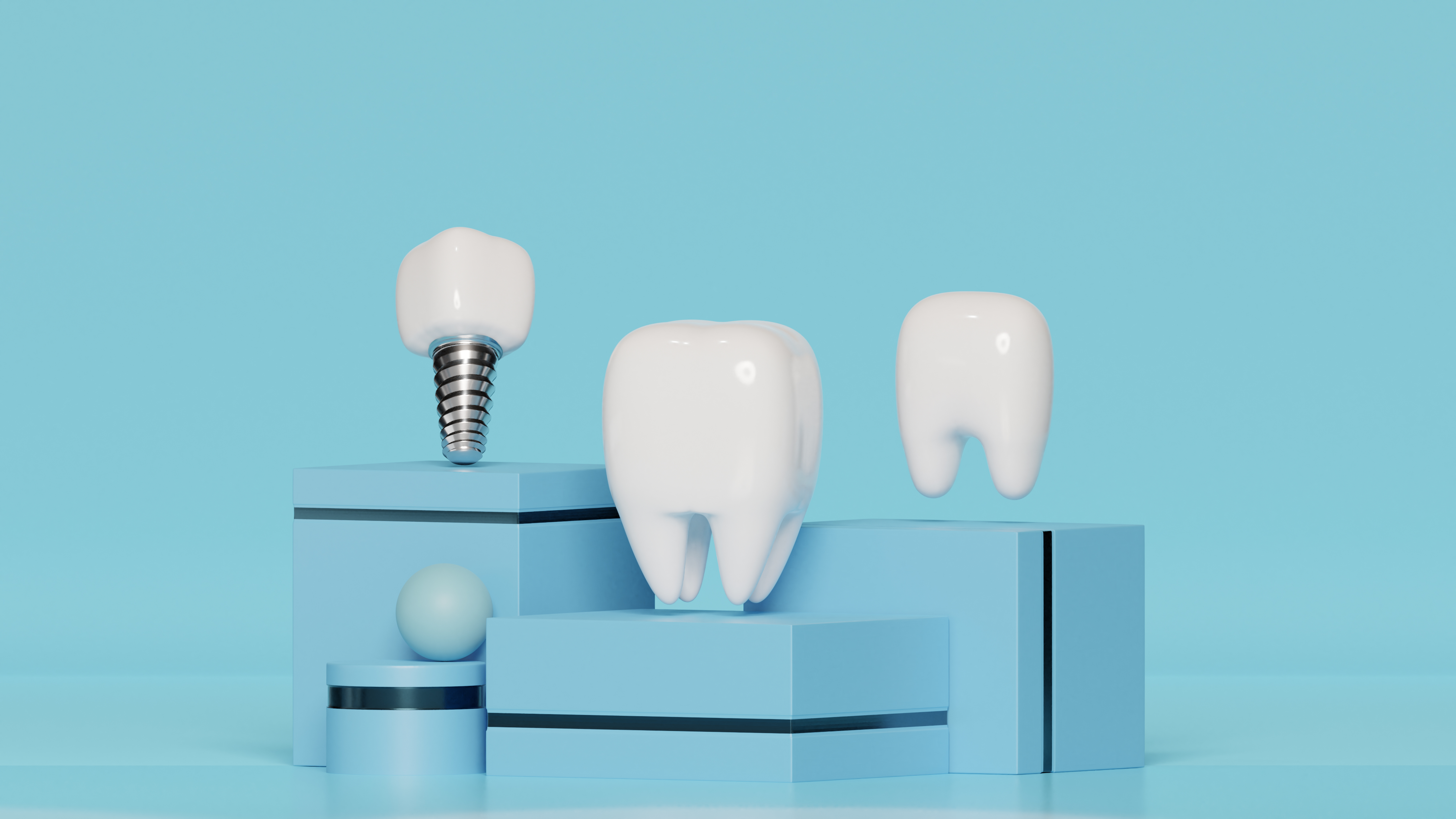 Dental Implants