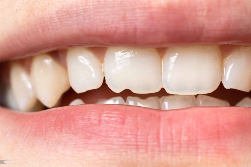 common dental problems