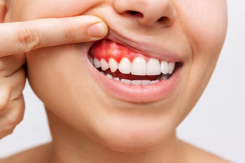 common dental problems