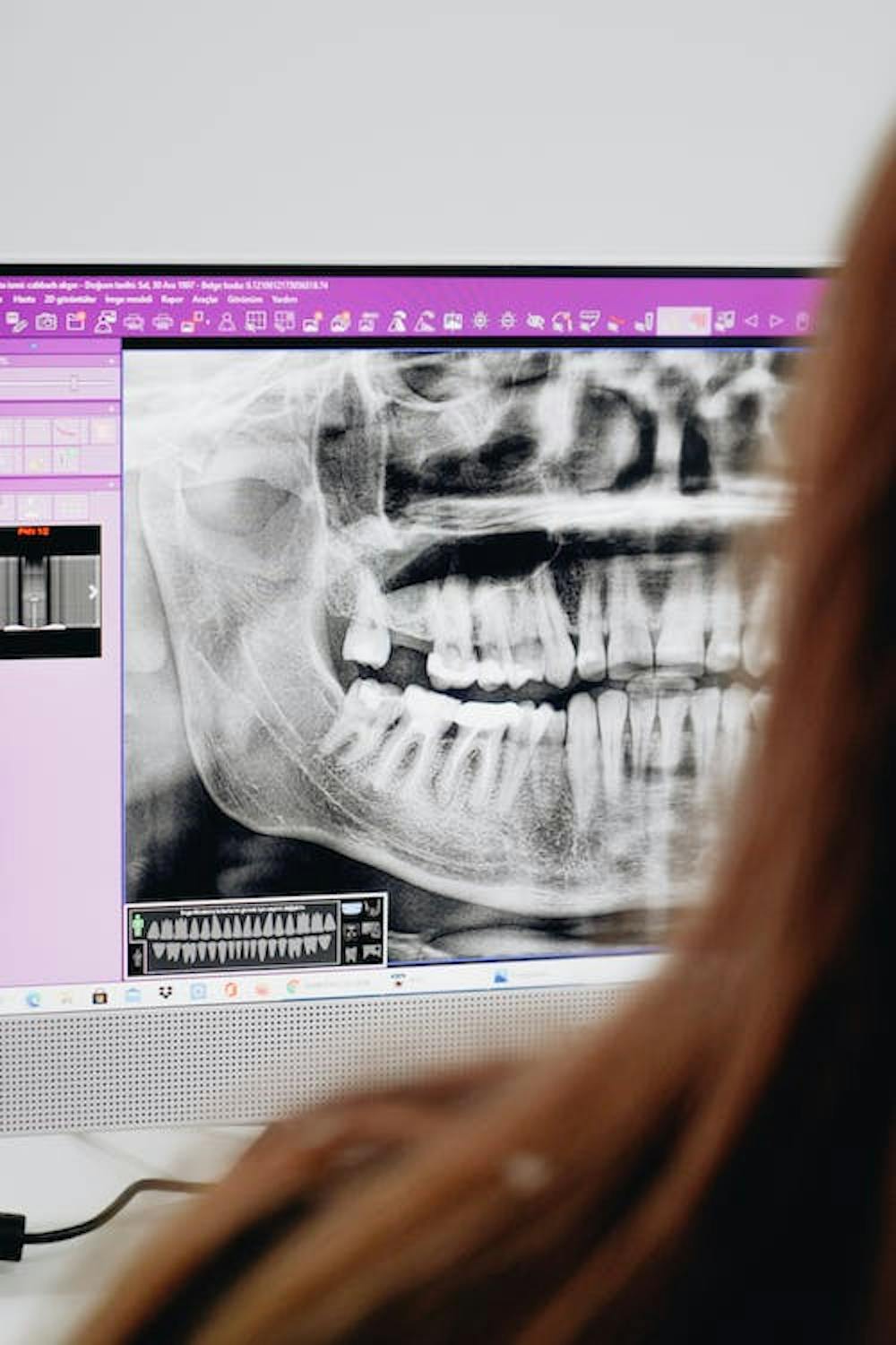 Best dental clinics that provide dental X-ray services image of a girl sitting in front of computer