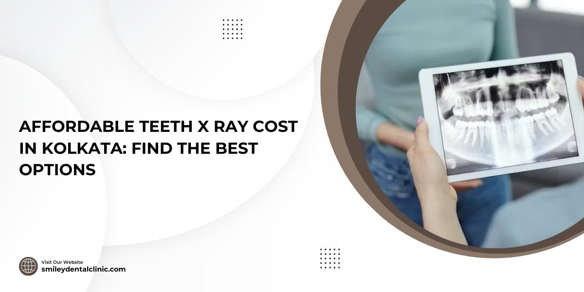 Affordable Teeth X Ray Cost in Kolkata: Find The Best Options - Blog Poster