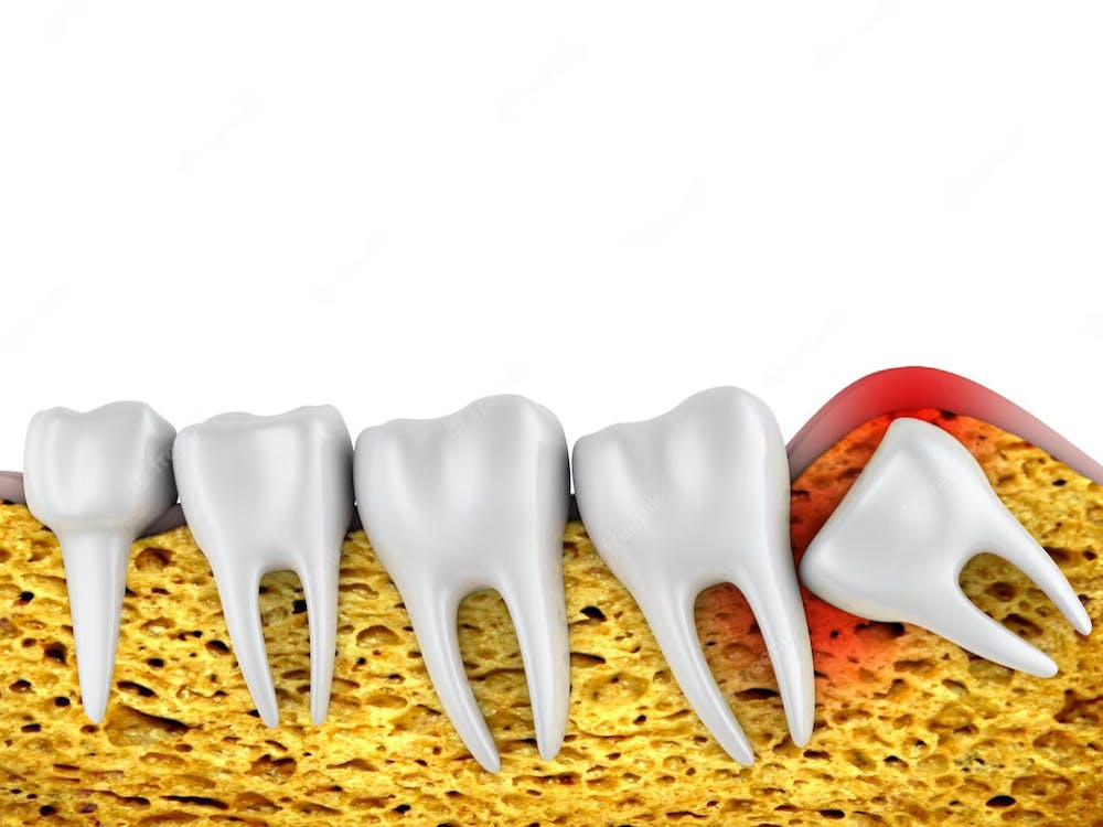 common dental problems
