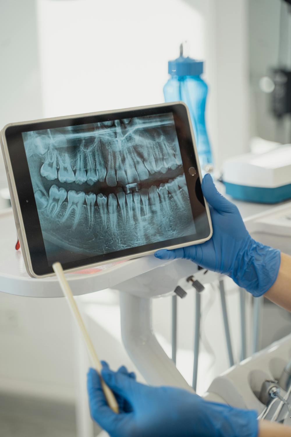 Photo of a oral X-ray in a tab