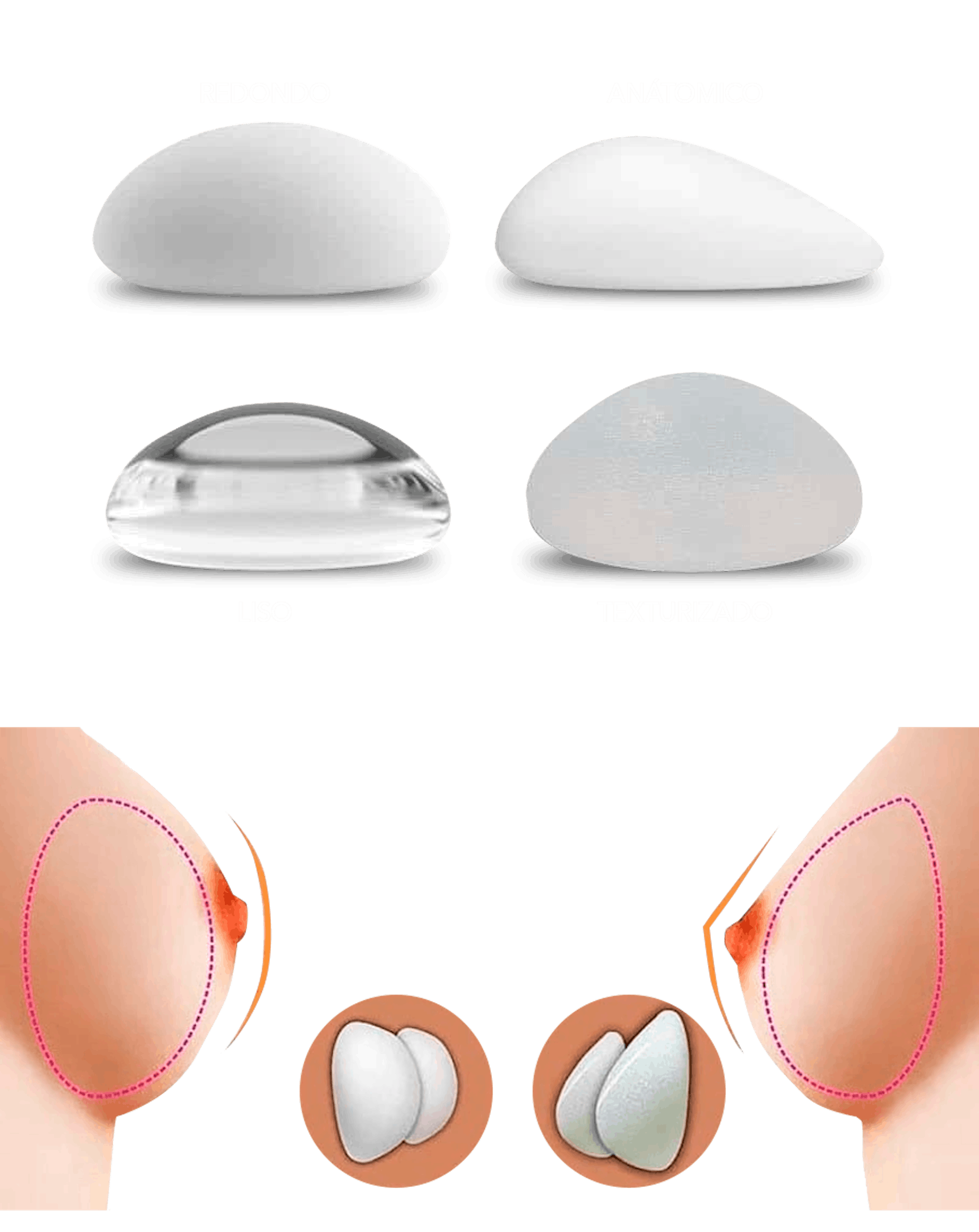 Breast Diagram