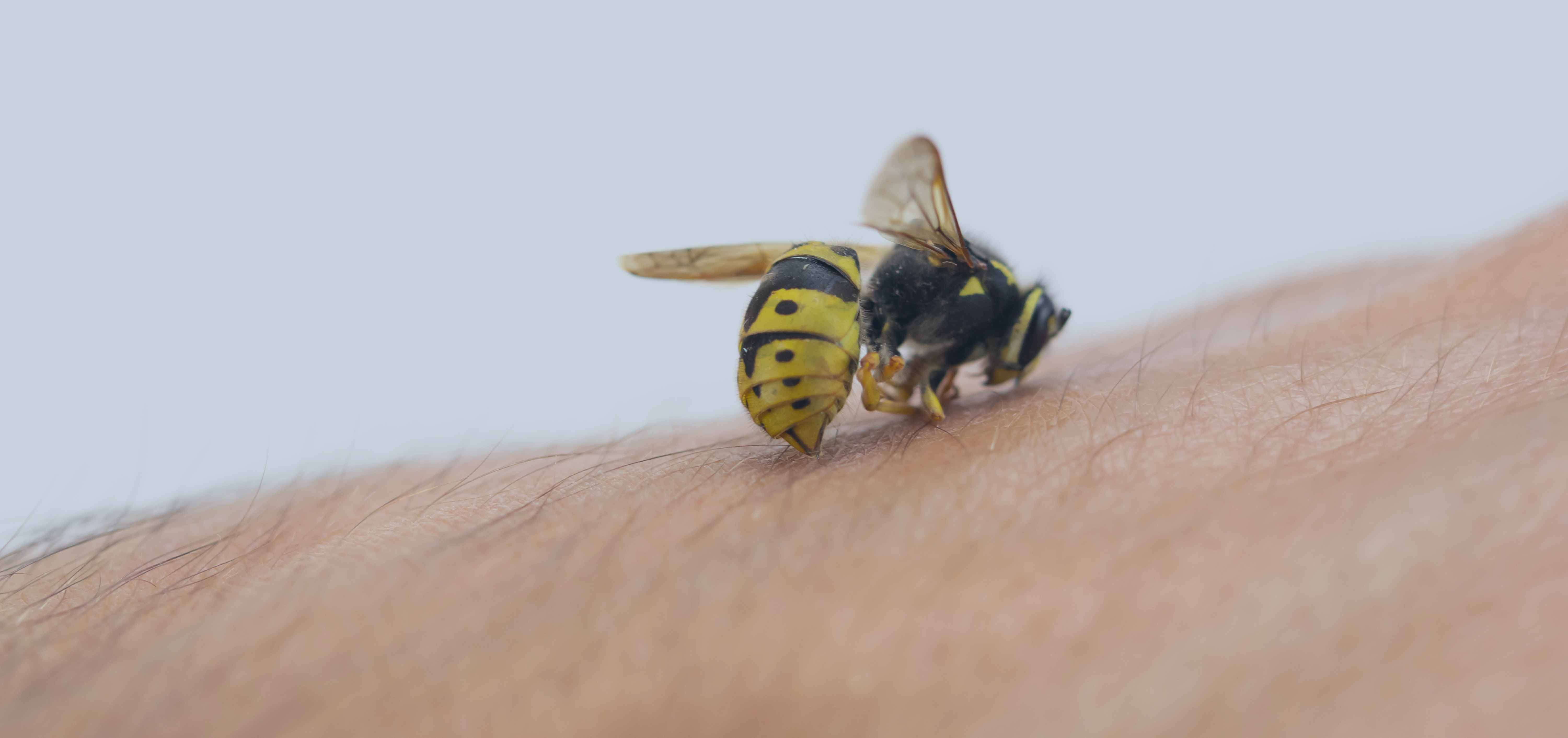 Что дают пчелы. Пчелиный яд. Пчелиный яд апитерапия. Яд пчелы. Пчела а жалит.