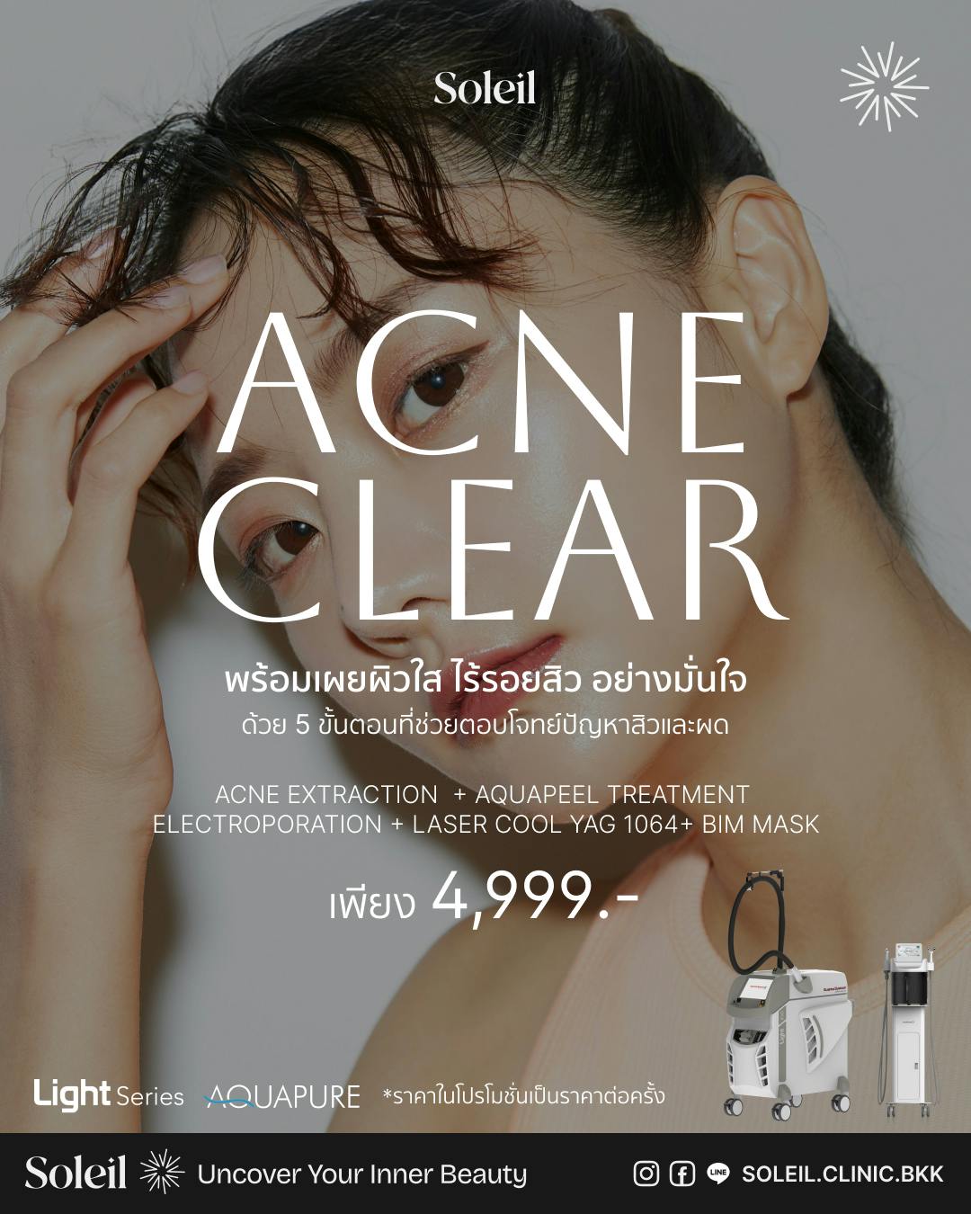 Acne Clear Program by Cool YAG 1064 + Aquapure Treatment