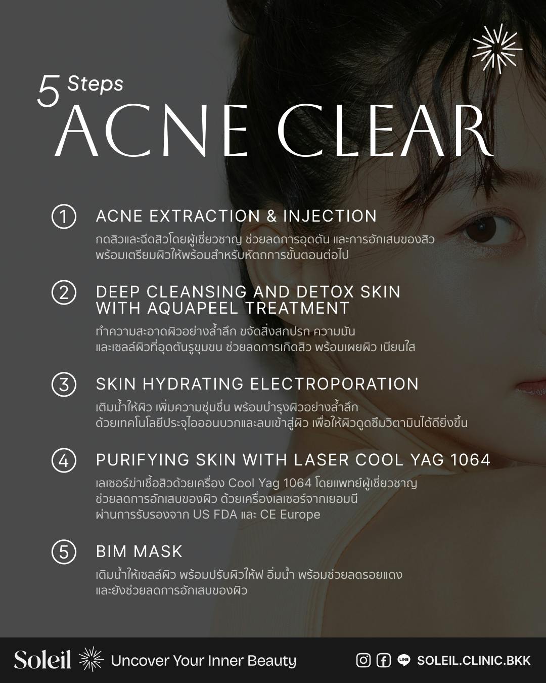 Acne Clear Program by Cool YAG 1064 + Aquapure Treatment