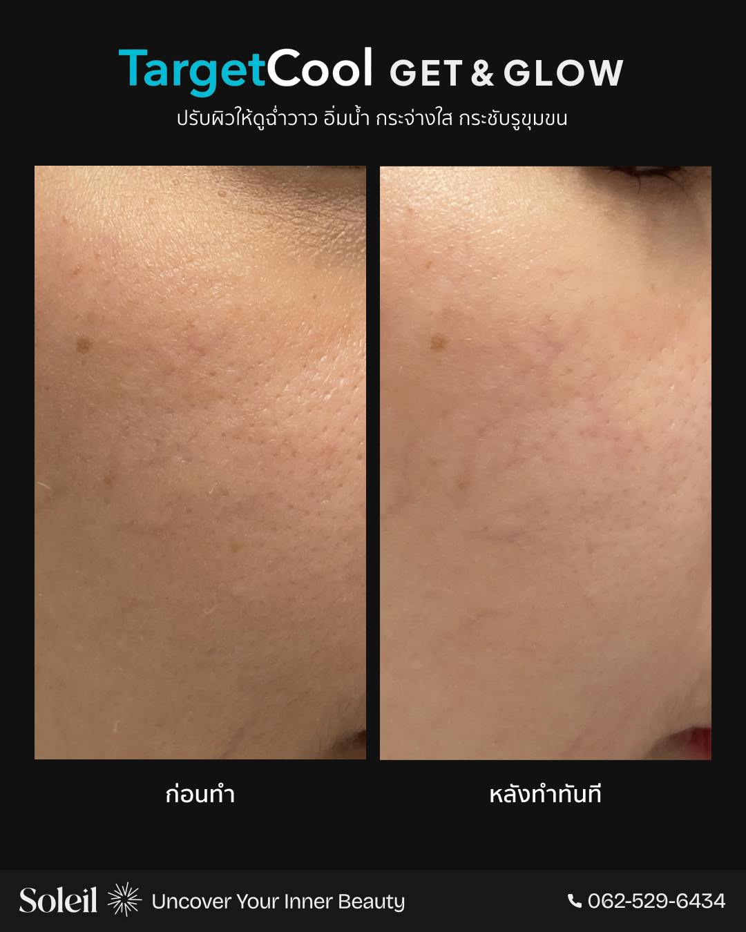 Before-After TargetCool-2