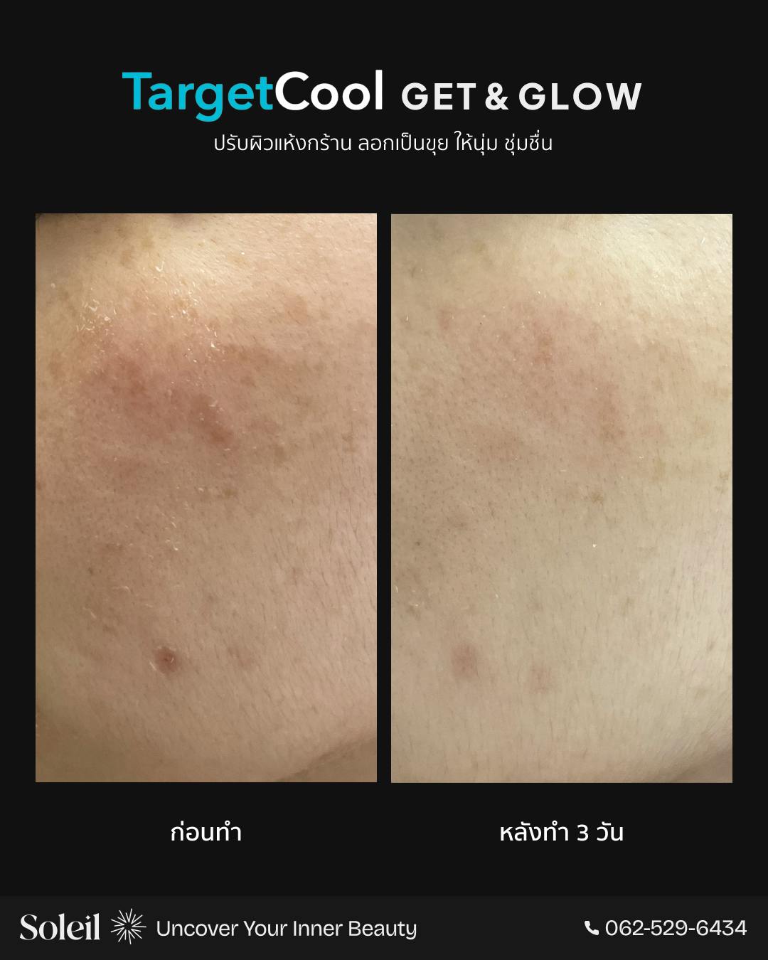 Before-After TargetCool-1