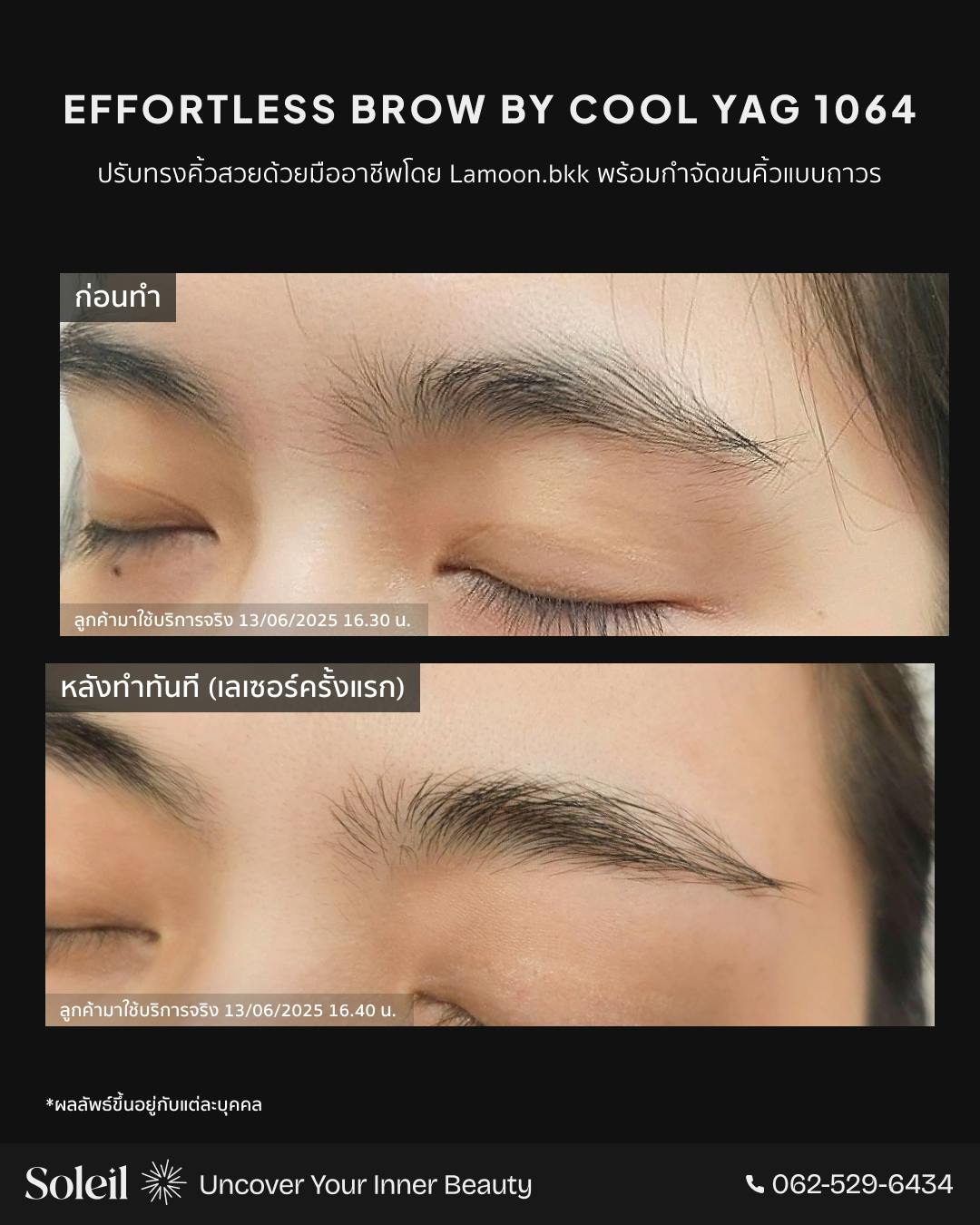 Before-After Effortless Brow