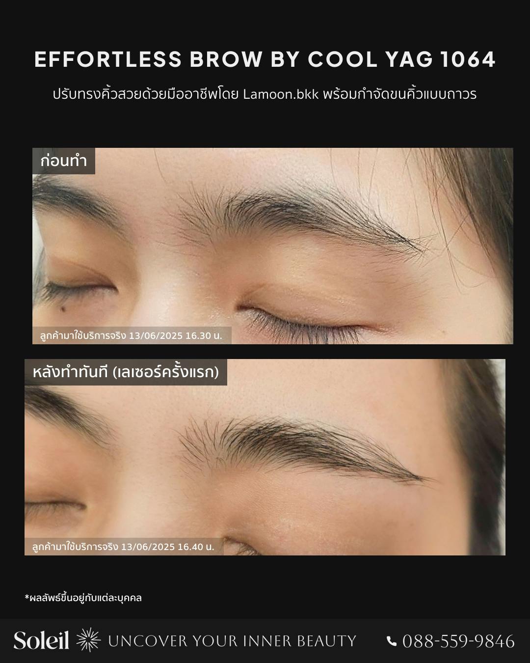 Before-After Effortless Brow