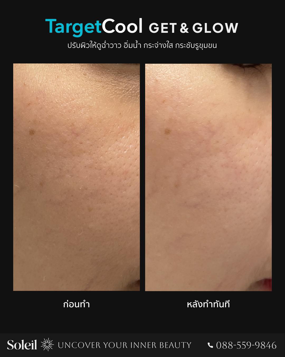 Before-After TargetCool-1