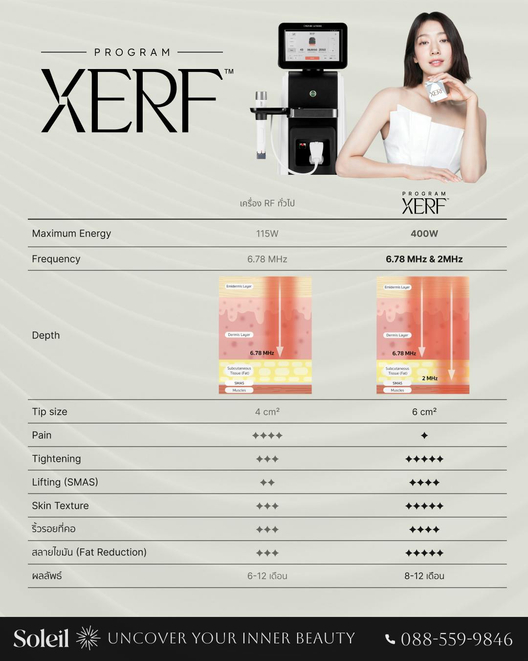 XERF ต่างจากเครื่อง RF ทั่วไปอย่างไร