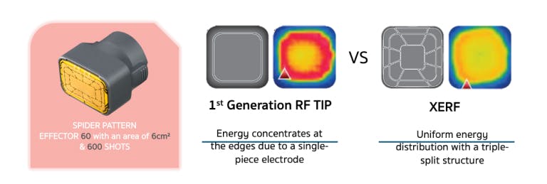 เปรียบเทียบหัวทิป XERF กับ RF