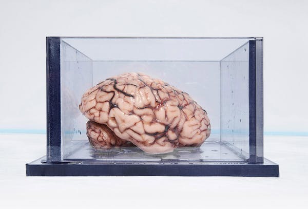 Henry Molaison's Brain / San Diego / California / 2009