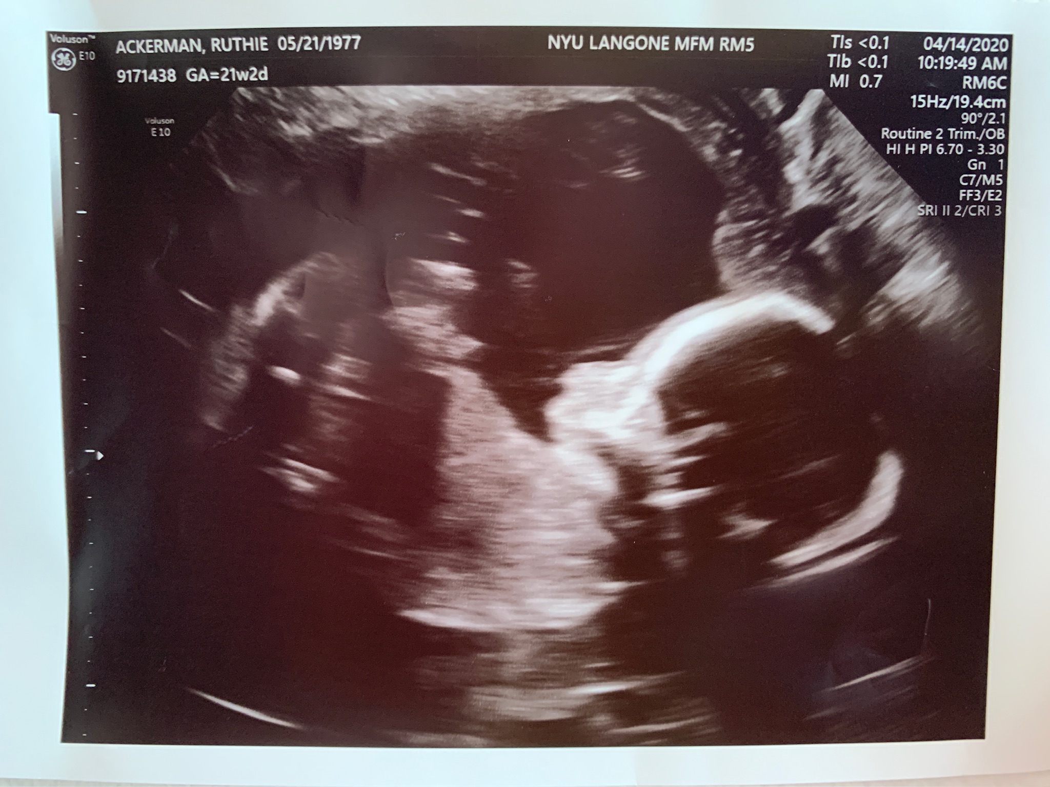 Image description not provided