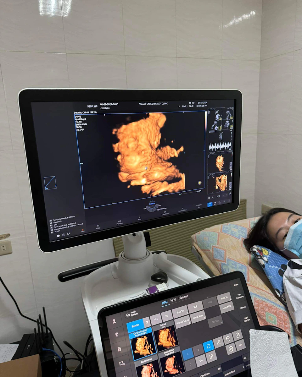 Image description not provided