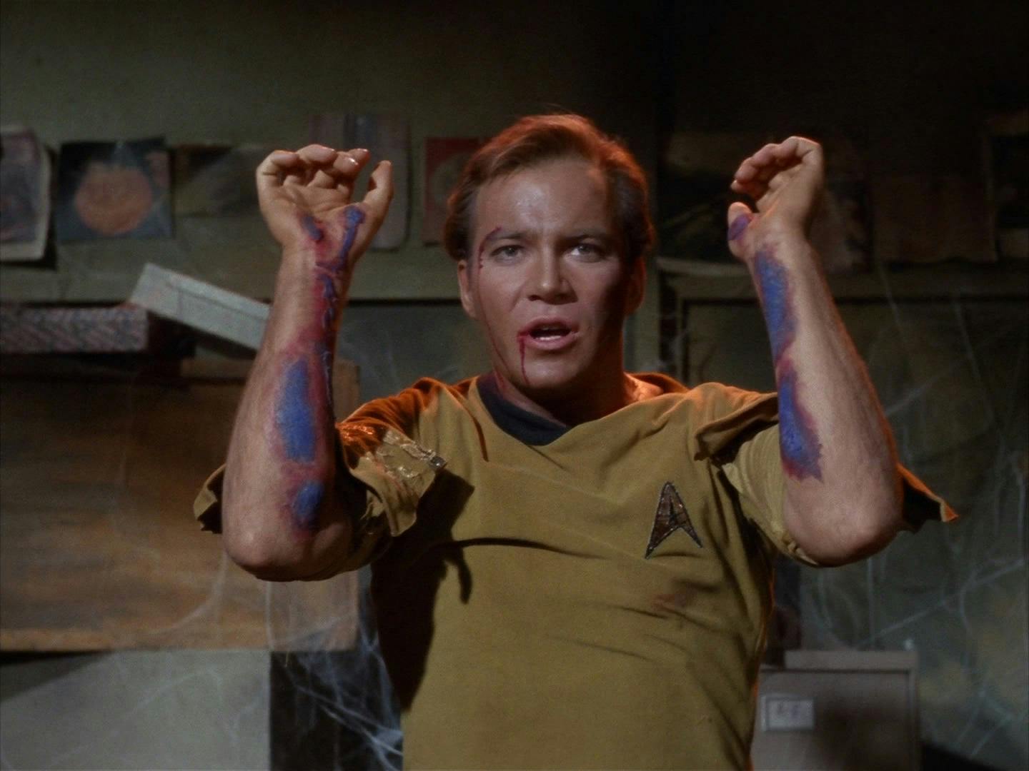 A battered and bloody Kirk with a torn uniform lifts both arms to show purple lesions all over in 'Miri'