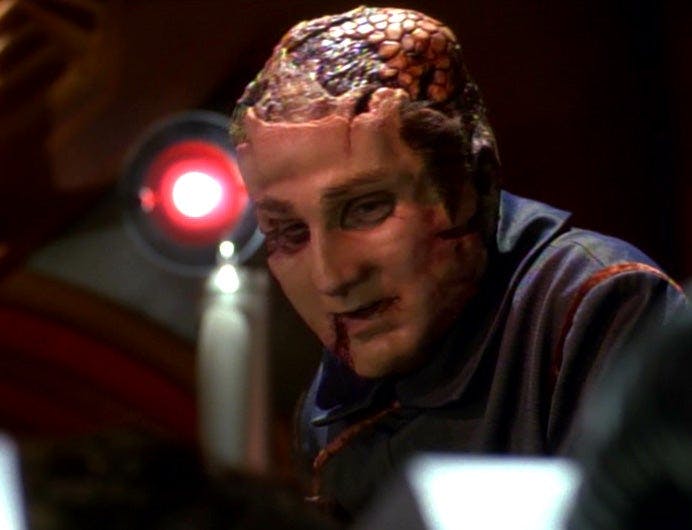 The Vidiian surgeon Sulan wears the face of Voyager crewmember Durst on top of his own in 'Faces'