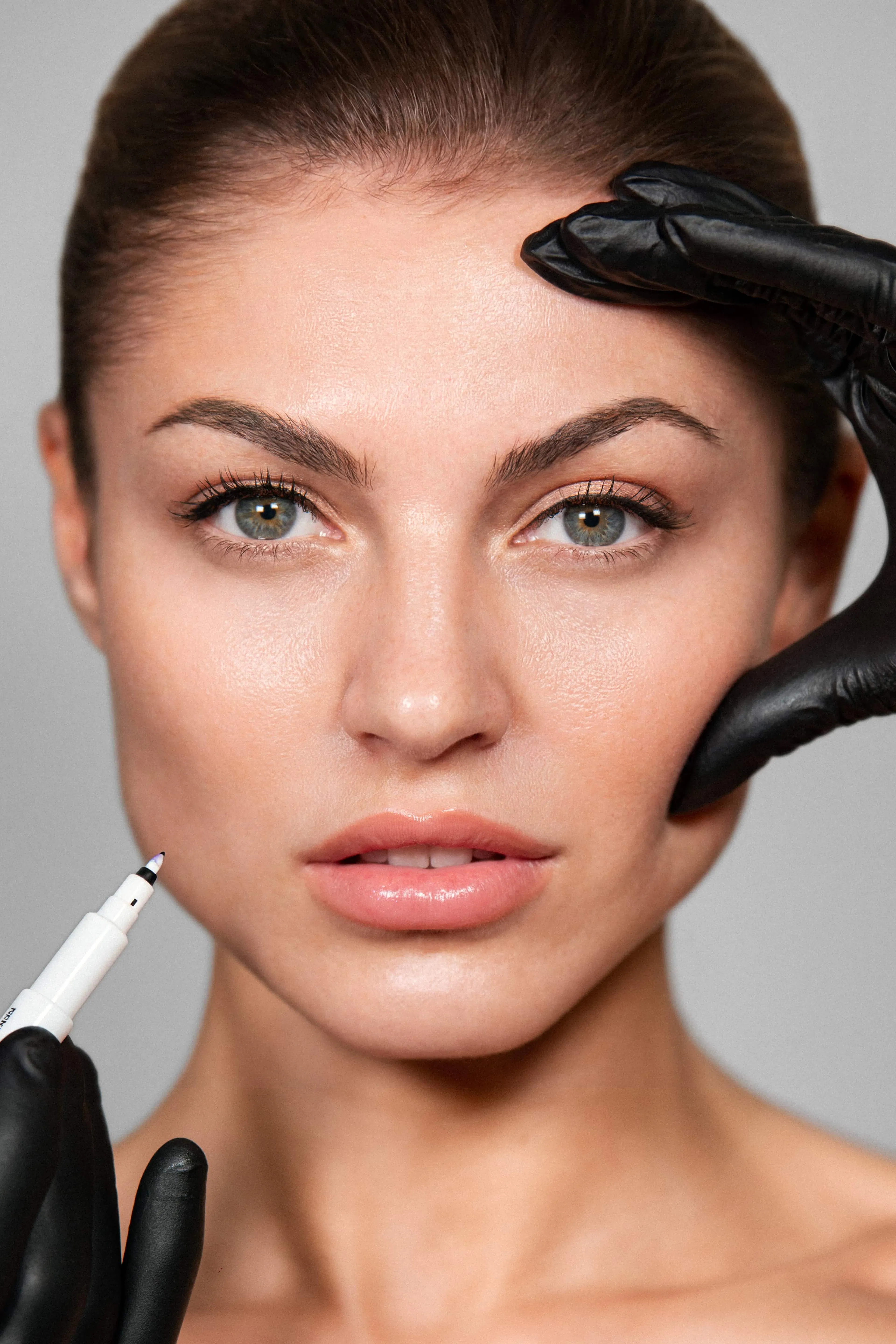 Patientin nach Jawline Unterspritzung - SA Aesthetics Berlin