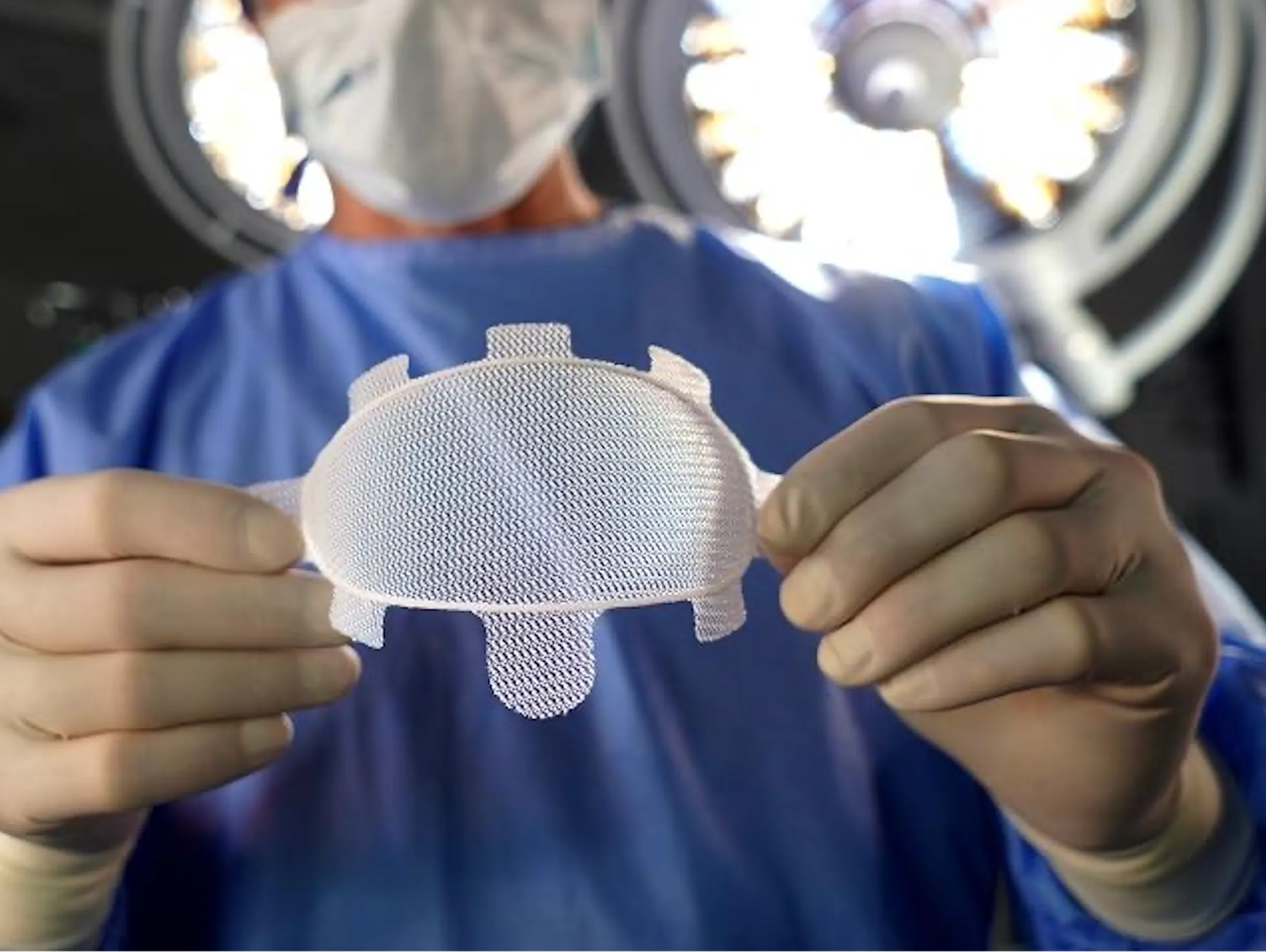 GalaFLEX® – Das bekannteste bioresorbierbare Stützmaterial