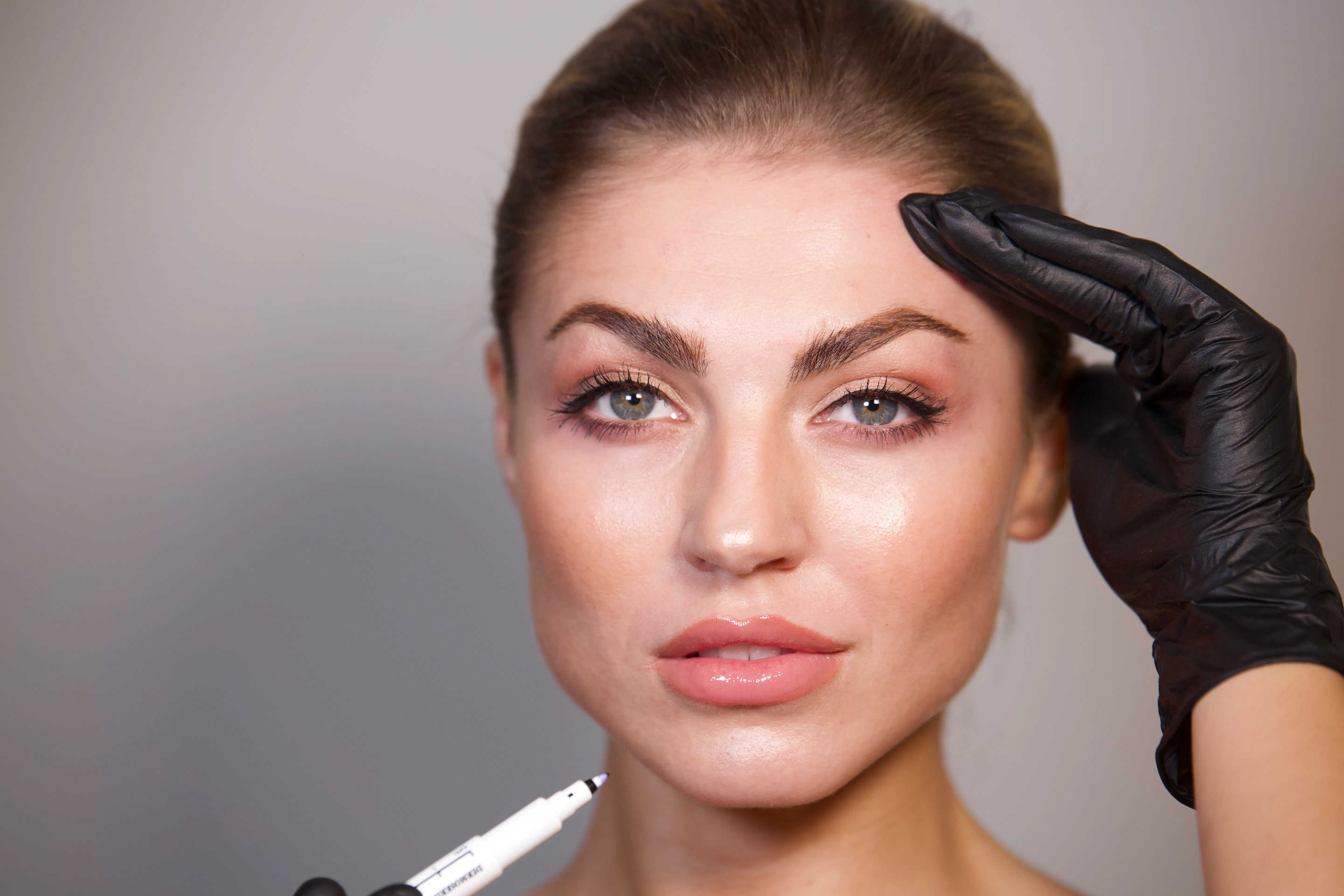 Botox Patientin - SA Aesthetics Berlin