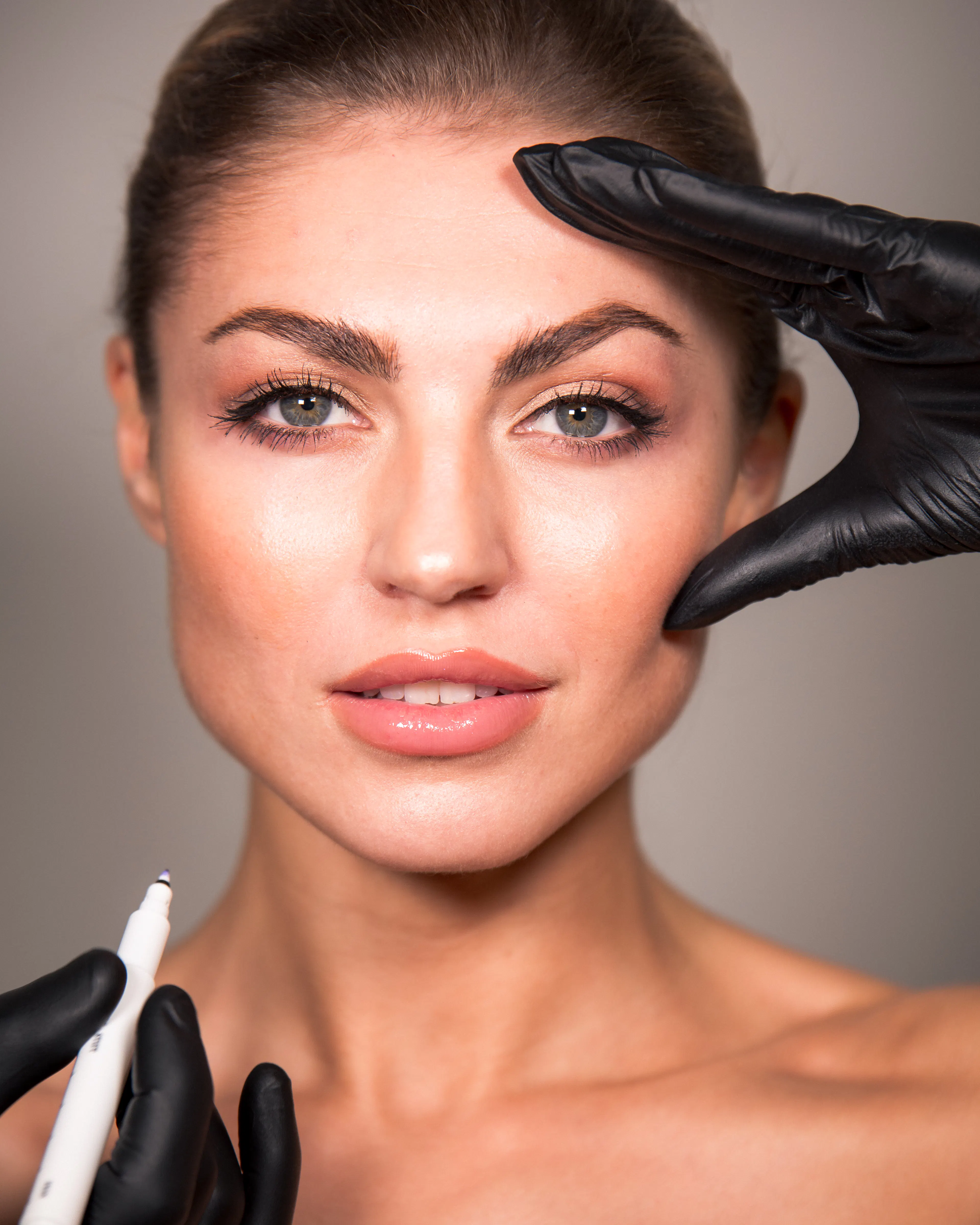 Botulinum Toxin Patientin - SA Aesthetics Berlin
